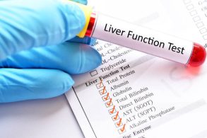 Blood sample for liver function test Blood sample for liver function test