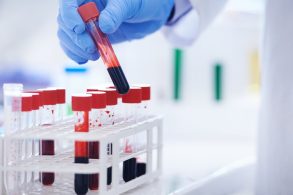 skynews-blood-test-generic_6681990 skynews-blood-test-generic_6681990